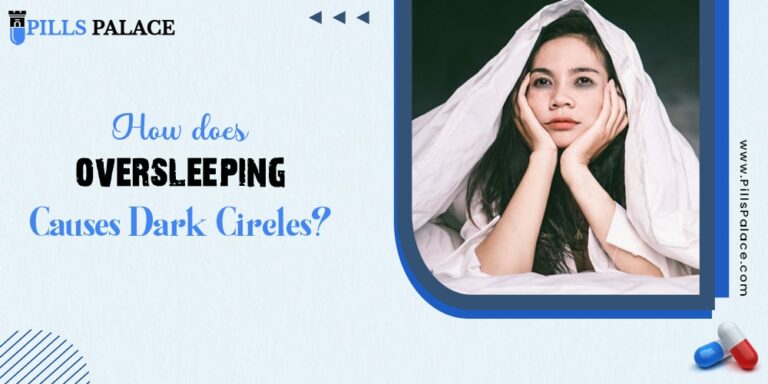 How does oversleeping causes dark circles?